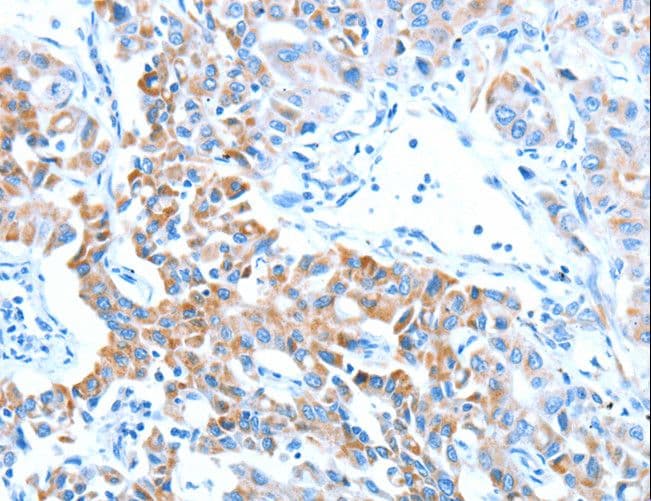 ALDH5A1 Antibody
