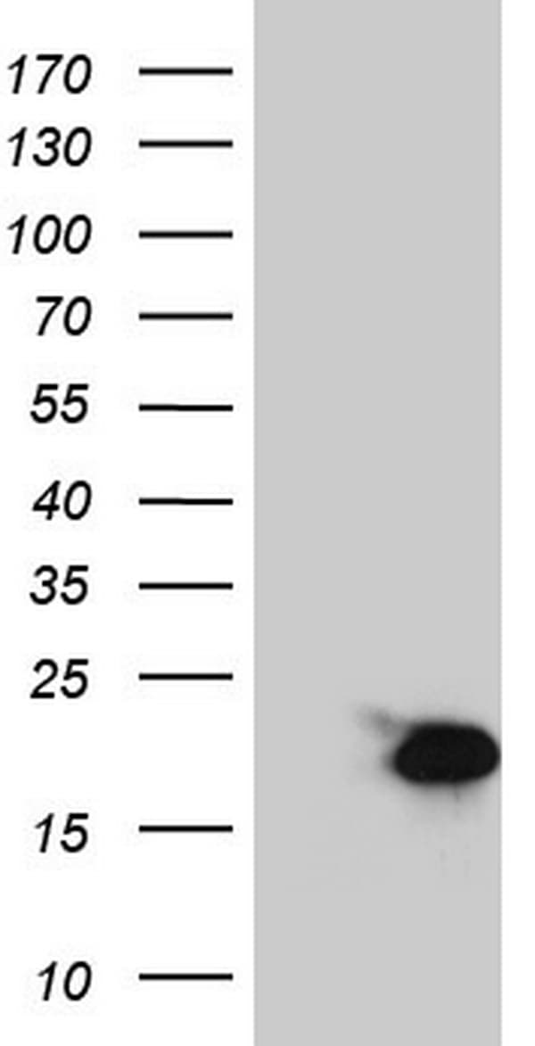 S100A9 / MRP14 Antibody (clone OTI11A12)