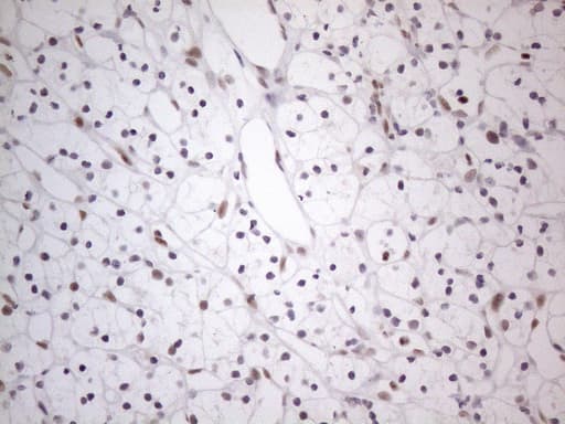 Monoclonal Mouse anti-Human TDG / Thymine DNA Glycosylase Antibody (clone OTI3C11, Carrier-free, aa160-253, IHC, WB)