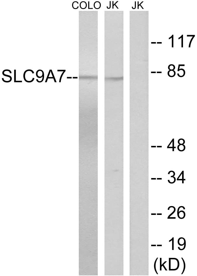 Polyclonal Rabbit anti-Human SLC9A7 Antibody (aa531-580, WB)