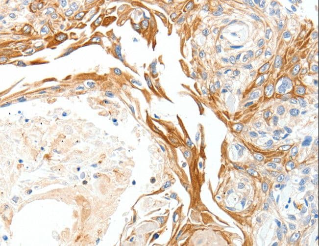 Polyclonal Rabbit anti-Human PLAT / TPA Antibody (IHC, WB)