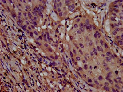 Polyclonal Rabbit anti-Human CLPTM1L / CLPTM1-Like Antibody (IHC, IF, WB)
