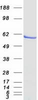 Human IRF5 Protein (Recombinant Myc-DDK (Flag))