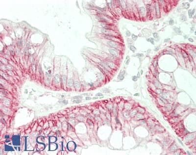 IHC-plus™ CA12 / Carbonic Anhydrase XII Antibody (aa224-273)