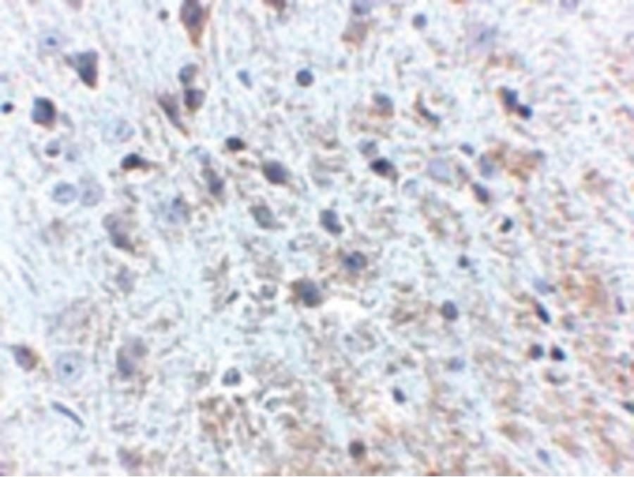 APP / Beta Amyloid Precursor Antibody