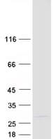 Human ZNF580 Protein (Recombinant Myc-DDK (Flag))