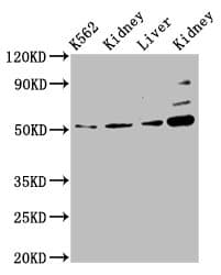 Polyclonal Rabbit anti-Human GSS / Glutathione Synthetase Antibody (IHC, WB)