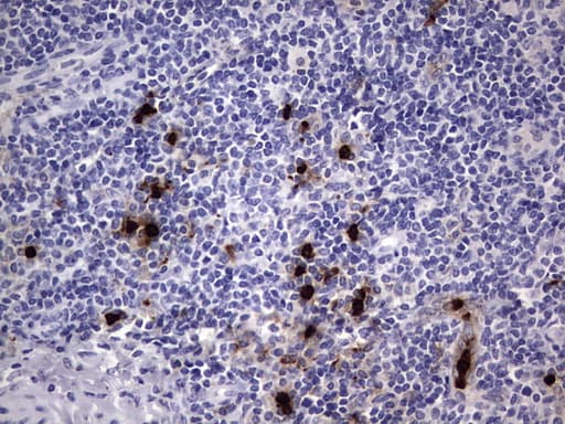 Monoclonal Mouse anti-Human CEACAM5 / CD66e Antibody (clone OTI3D8, aa35-680, IHC, WB)