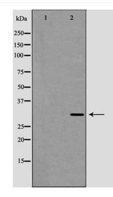 CD27L / CD70 Antibody