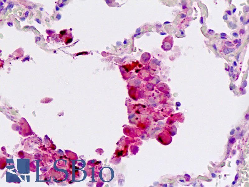 IHC-plus™ WIF1 Antibody (aa51-80)