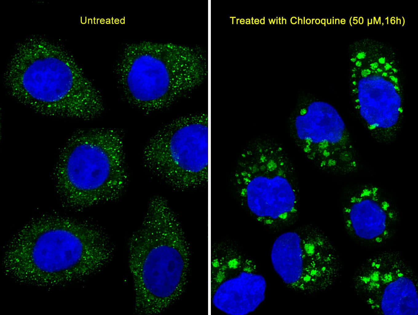 Polyclonal Rabbit anti-Human MAP1LC3B / LC3B Antibody (aa1-30, IHC, IF, WB)