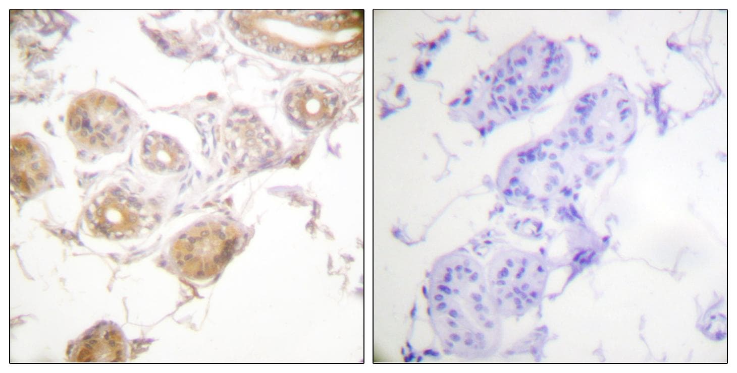 ETK / BMX Antibody (phospho-Tyr40)