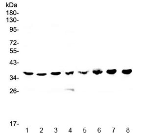 Polyclonal Rabbit anti-Human HNRNPA2B1 Antibody (WB)