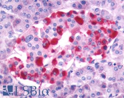 PathPlus™ Polyclonal Rabbit anti-Human GRPR Antibody (Extracellular Domain, IHC, WB)