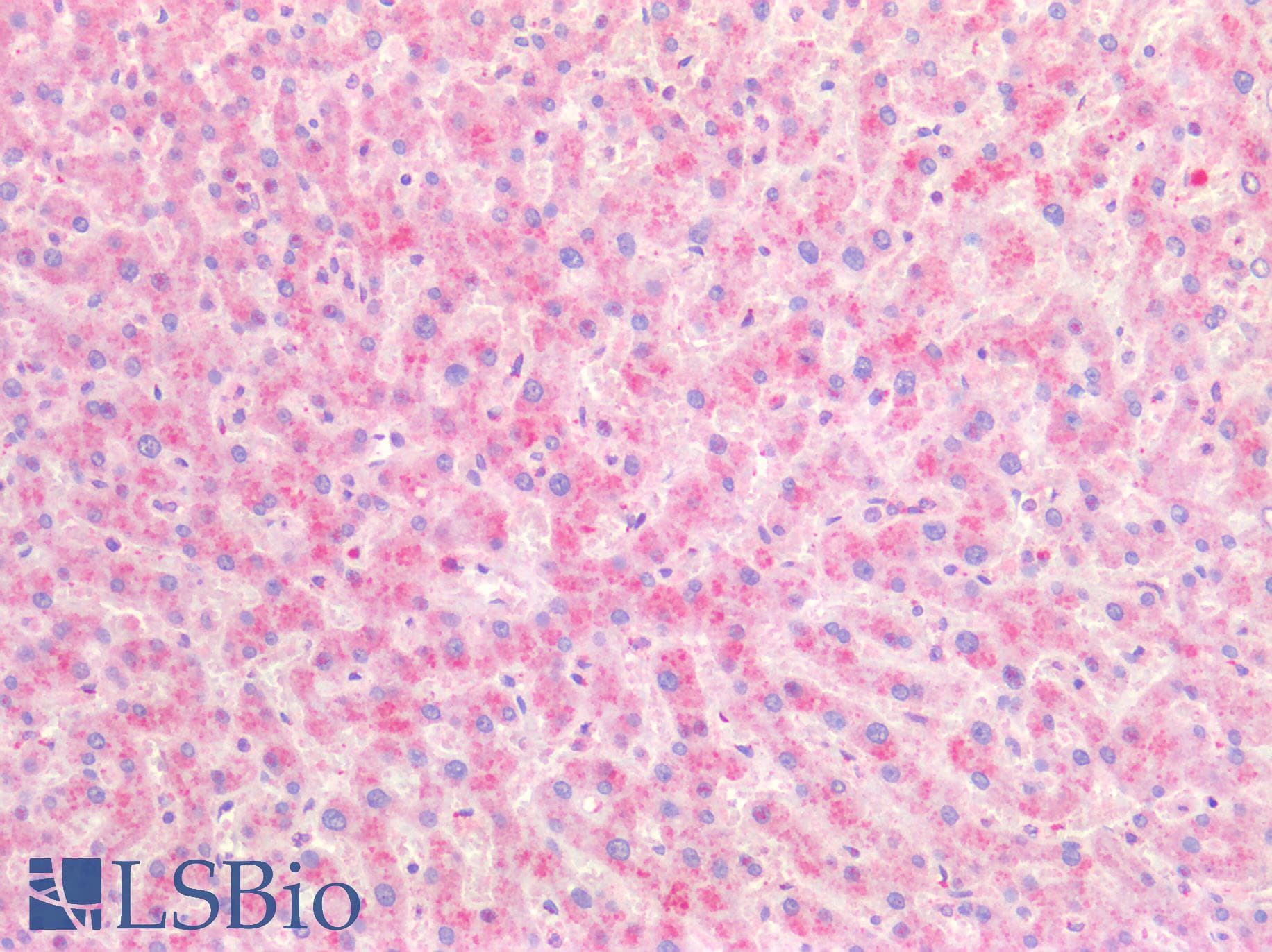 IHC-plus™ Polyclonal Goat anti-Human CAT / Catalase Antibody (IHC, WB)