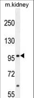 MED25 Antibody (aa112-140)