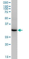 Esterase D / ESD Antibody (clone 1E1)
