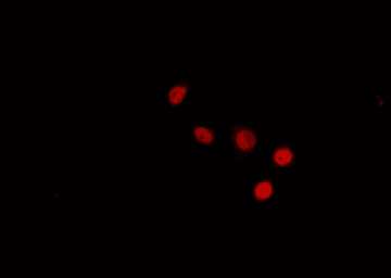 Polyclonal Rabbit anti-Human SIN3B Antibody (IHC, IF, WB)