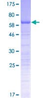 Human PSRC1 / DDA3 Protein (Recombinant GST)