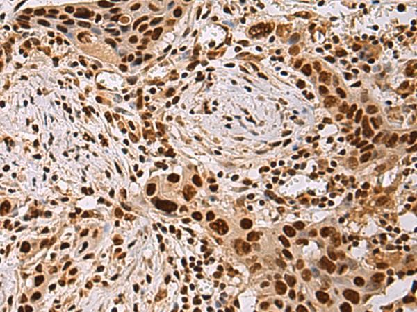 HDAC1 Antibody