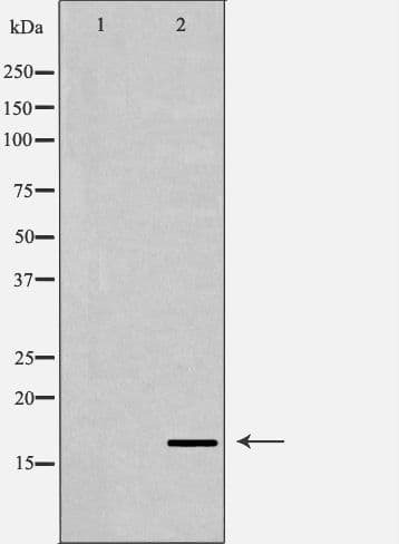 NPPA / ANP Antibody