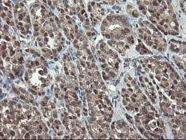 GORAB / SCYL1BP1 Antibody (aa35-394, clone OTI4F11, Carrier-free)