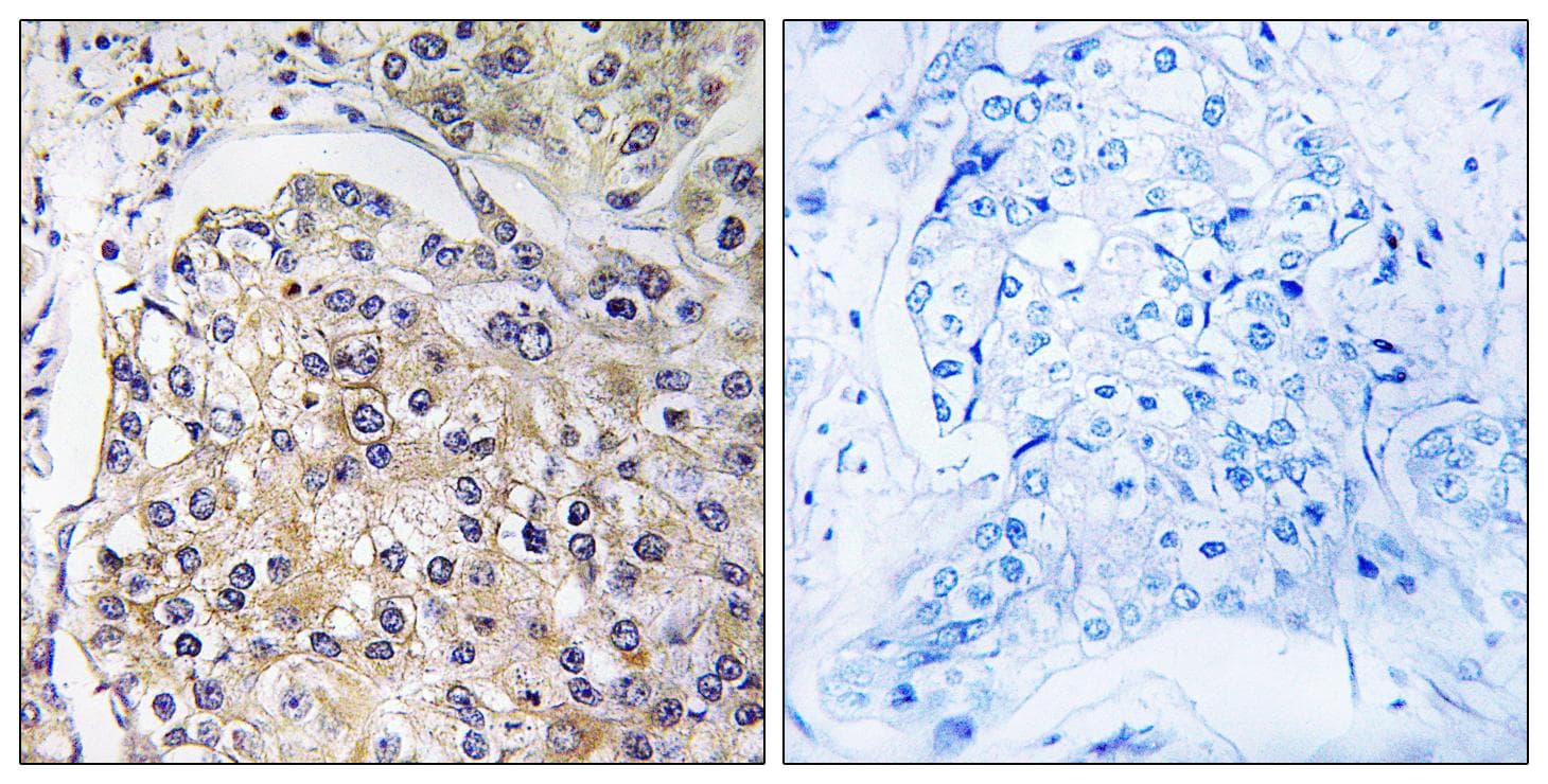 Polyclonal Rabbit anti-Human ADGRF5 / GPR116 Antibody (IHC, IF)