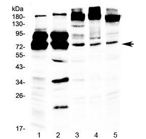 DDX3 / DDX3X Antibody