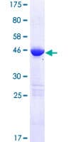 Human LZIC Protein (Recombinant GST)