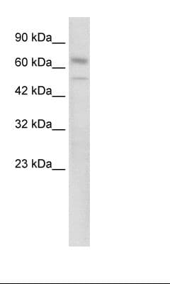 Polyclonal Rabbit anti-Human ZKSCAN3 / ZNF306 Antibody (N-Terminus, WB)