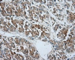 SRR / Serine Racemase Antibody (clone OTI3B5)