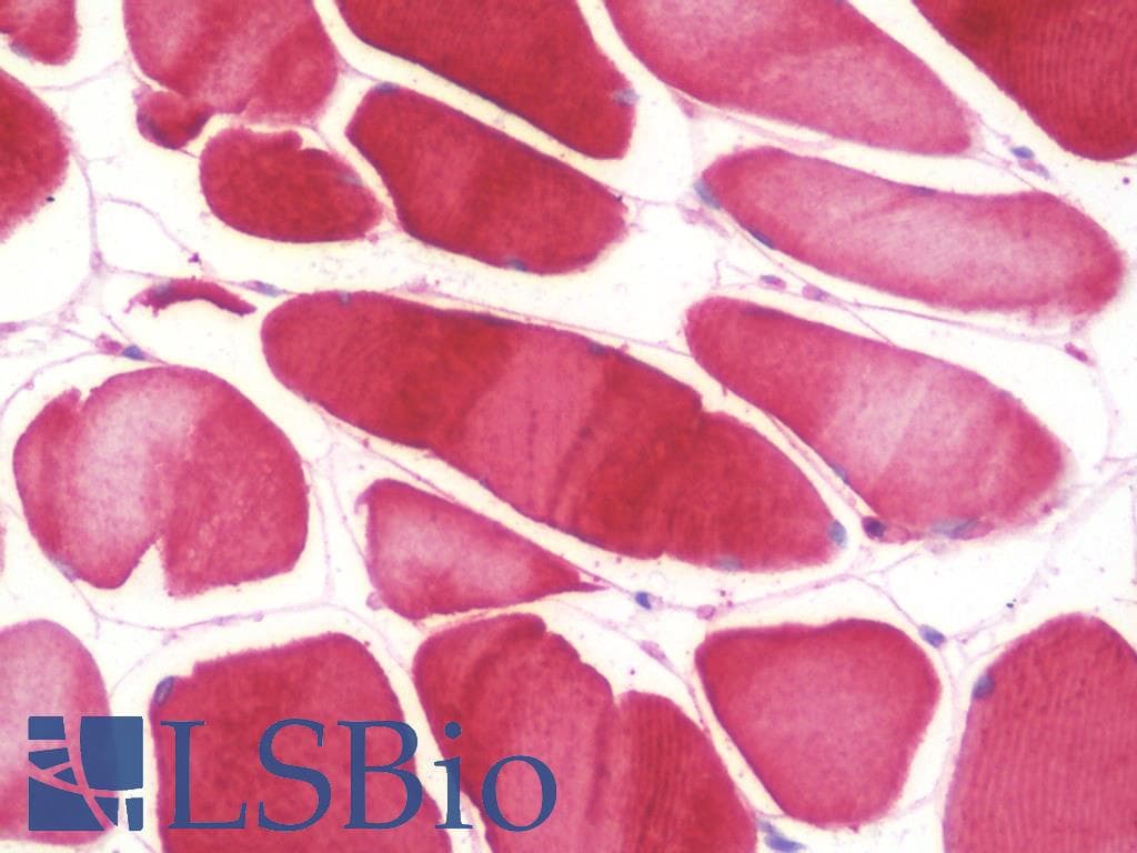 PathPlus™ NOS2 / iNOS Antibody (aa997-1058, clone 4E5)