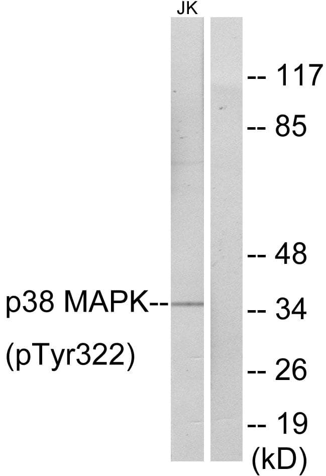 MAPK14 / p38 Antibody (phospho-Tyr322)