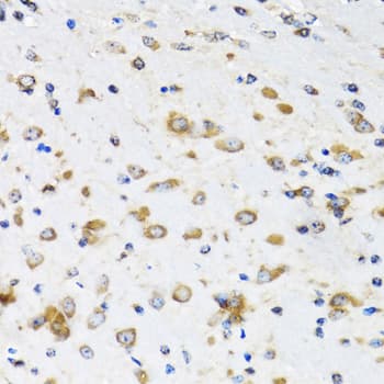 Polyclonal Rabbit anti-Human COPB2 / Beta-COP Antibody (IHC, IF, WB)