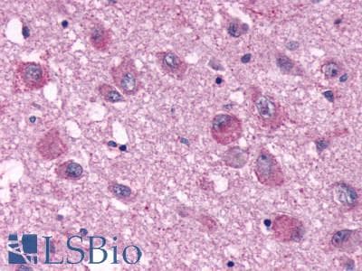 PathPlus™ NPY4R / PPYR1 Antibody (Extracellular Domain)