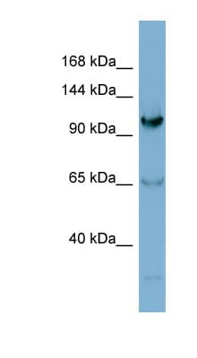 Polyclonal Rabbit anti-Human GEMIN4 Antibody (aa287-336, WB)