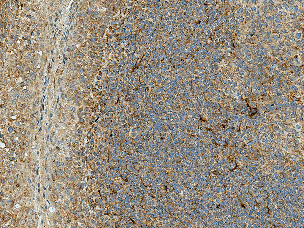 KIAA0226 / RUBICON Antibody (PerCP)