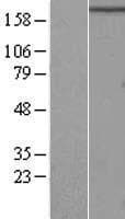 RB1CC1 / CC1 Protein (Over-Expression Lysate Myc-DDK (Flag))