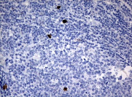 PBX1 Antibody (clone UMAB110, Carrier-free)
