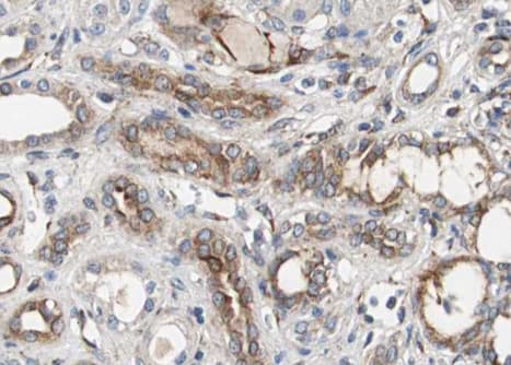 KDR / VEGFR2 / FLK1 Antibody (phospho-Tyr951)