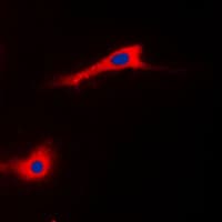 IHC-plus™ ADCK3 / CABC1 Antibody (Internal)