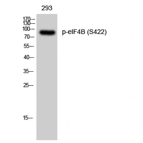 EIF4B Antibody (360-440 aa)