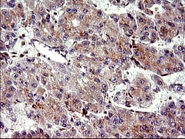 Monoclonal Mouse anti-Human CHAC1 / MGC4504 Antibody (clone OTI1E2, Carrier-free, IHC, IF, WB)