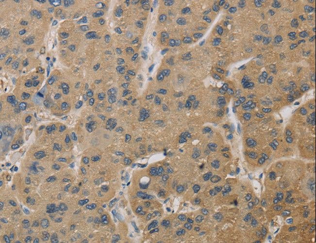 TS / Thromboxane Synthase Antibody