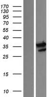 CDK20 / CCRK Protein (Over-Expression Lysate Myc-DDK (Flag))
