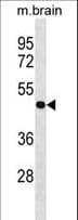 Polyclonal Rabbit anti-Human PPP4R2 Antibody (aa228-254, WB)