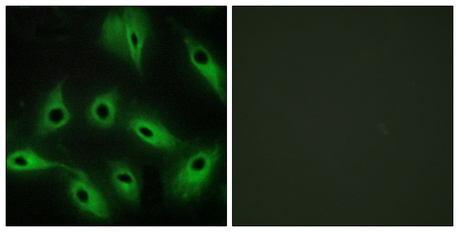 CDH9 / Cadherin 9 Antibody (aa201-250)