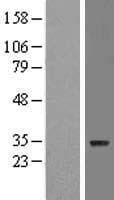 ZNF688 Protein (Over-Expression Lysate Myc-DDK (Flag))