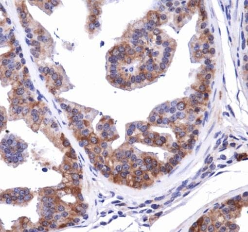 NBR1 Antibody (Biotin)
