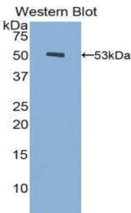FGB / Fibrinogen Beta Chain Antibody (aa45-491)